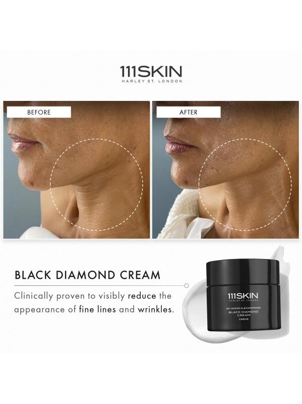 #5: كريم بلاك دايموند - NO COLOR