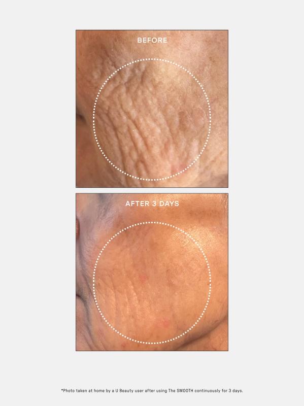 #6: سيروم ذا سموث دايناميك ضد التجاعيد - NO COLOR